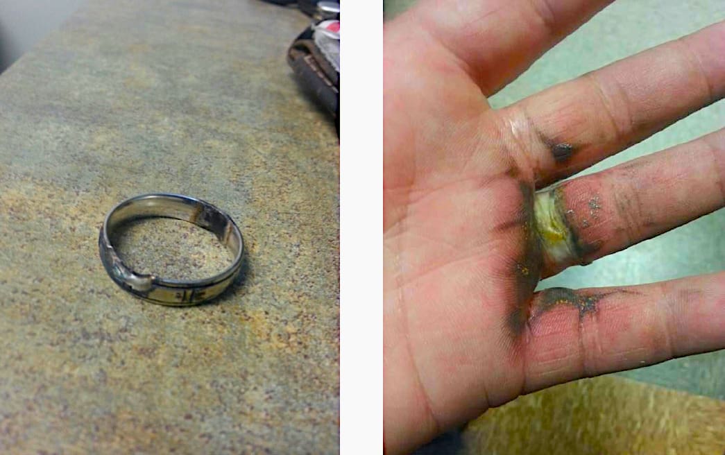 Do not wear conducive article of jewelry and clothing